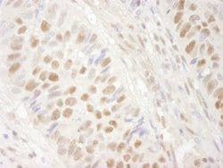 BRG1/SMARCA4 Polyclonal Antibody, Bethyl Laboratories 10 &mu;L | Buy Online | Bethyl Laboratories, Inc | Fisher Scientific