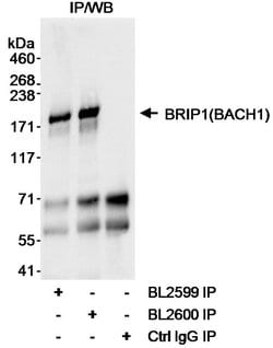 BRIP1 Rabbit anti-Human, Polyclonal, Bethyl Laboratories 100 &mu;L; Unconjugated:Antibodies,