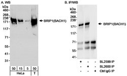 BRIP1 Rabbit anti-Human, Polyclonal, Bethyl Laboratories 100 &mu;L; Unconjugated:Antibodies,