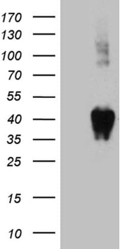 BST1 Monoclonal Antibody (OTI9B2), TrueMAB , OriGene:Antibodies:Primary