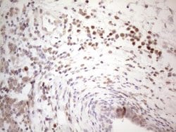 BTBD10 Monoclonal Antibody (OTI7D3), TrueMAB , OriGene 100 &mu;L; Unconjugated:Antibodies,