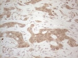 BTBD10 Monoclonal Antibody (OTI7D3), TrueMAB , OriGene 100 &mu;L; Unconjugated:Antibodies,