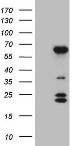 BTBD10 Monoclonal Antibody (OTI7D3), TrueMAB , OriGene 100 &mu;L; Unconjugated:Antibodies,