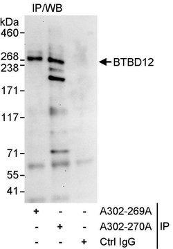 BTBD12 Rabbit anti-Human, Polyclonal, Bethyl Laboratories 100 &mu;l; Unlabeled:Antibodies,