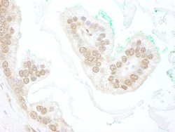 BTBD12 Polyclonal Antibody, Bethyl Laboratories 100 &mu;L; Unconjugated:Antibodies,