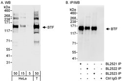 BTF Rabbit anti-Human, Polyclonal, Bethyl Laboratories 100 &mu;L; Unconjugated:Antibodies,
