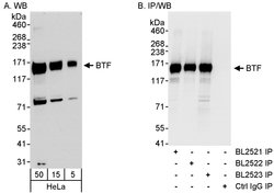 BTF Rabbit anti-Human, Polyclonal, Bethyl Laboratories 100 &mu;L; Unconjugated:Antibodies,