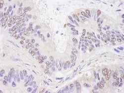BTF Polyclonal Antibody, Bethyl Laboratories 10 &mu;L; Unconjugated:Antibodies,