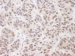 BTF Polyclonal Antibody, Bethyl Laboratories 10 &mu;L; Unconjugated:Antibodies,