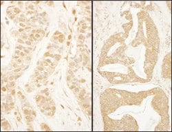 BTF3 Rabbit anti-Human, Polyclonal, Bethyl Laboratories 10 &mu;L; Unconjugated:Antibodies,