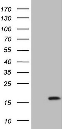 BTG2 Monoclonal Antibody (OTI2G5), TrueMAB , OriGene 100 &mu;L; Unconjugated:Antibodies,