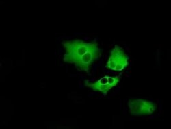 BTK Monoclonal Antibody (OTI12D4), TrueMAB , OriGene:Antibodies:Primary