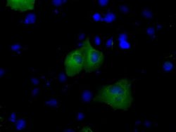 BTK Monoclonal Antibody (OTI12H4), TrueMAB , OriGene 30 &mu;L; Unconjugated:Antibodies,
