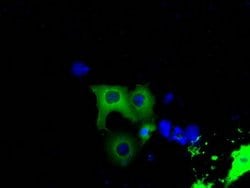 BTK Mouse anti-Human, Clone: OTI6H9, lyophilized, TrueMAB 100 &mu;g; Unconjugated:Antibodies,