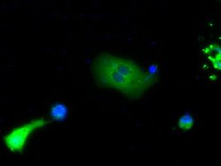 BTK Mouse anti-Human, Clone: OTI3E9, lyophilized, TrueMAB 100 &mu;g; Unconjugated:Antibodies,