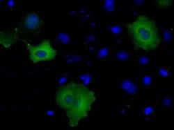 BTK Monoclonal Antibody (OTI1H7), TrueMAB , OriGene 100 &mu;L; Unconjugated:Antibodies,