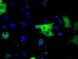 BTK Mouse anti-Human, Clone: OTI10E10, liquid, TrueMAB 100 &mu;L; Unconjugated:Antibodies,