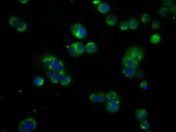 BTK Mouse anti-Human, Clone: OTI10E10, liquid, TrueMAB 100 &mu;L; Unconjugated:Antibodies,