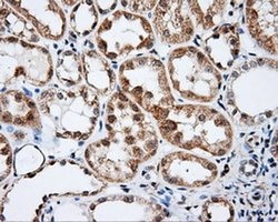 BTK Monoclonal Antibody (OTI12D4), TrueMAB , OriGene 100 &mu;L; Unconjugated:Antibodies,