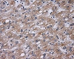 BTK Monoclonal Antibody (OTI12D4), TrueMAB , OriGene 100 &mu;L; Unconjugated:Antibodies,
