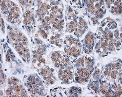 BTK Monoclonal Antibody (OTI12D4), TrueMAB , OriGene:Antibodies:Primary