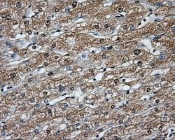BTK Mouse anti-Human, Clone: OTI12H4, lyophilized, TrueMAB 100 &mu;g; Unconjugated:Antibodies,
