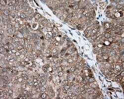 BTK Mouse anti-Human, Clone: OTI6H9, lyophilized, TrueMAB 100 &mu;g; Unconjugated:Antibodies,