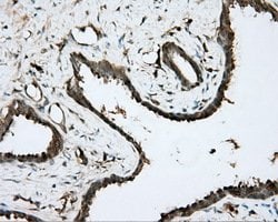 BTK Mouse anti-Human, Clone: OTI6H9, lyophilized, TrueMAB 100 &mu;g; Unconjugated:Antibodies,