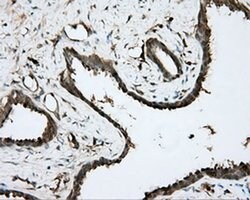 BTK Monoclonal Antibody (OTI6H9), TrueMAB , OriGene 100 &mu;L; Unconjugated:Antibodies,