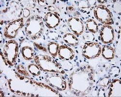 BTK Mouse anti-Human, Clone: OTI3E9, lyophilized, TrueMAB 100 &mu;g; Unconjugated:Antibodies,