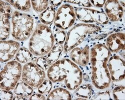 BTK Monoclonal Antibody (OTI1H7), TrueMAB , OriGene 100 &mu;L; Unconjugated:Antibodies,