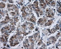 BTK Monoclonal Antibody (OTI1H7), TrueMAB , OriGene 100 &mu;L; Unconjugated:Antibodies,