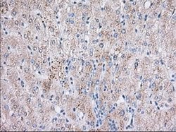 BTK Mouse anti-Human, Clone: OTI10E10, liquid, TrueMAB 100 &mu;L; Unconjugated:Antibodies,