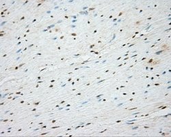 BTK Monoclonal Antibody (OTI15G8), TrueMAB , OriGene 30 &mu;L; Unconjugated:Antibodies,