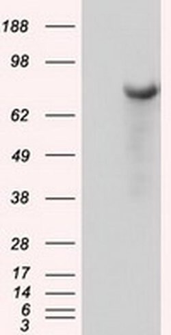 BTK Monoclonal Antibody (OTI12D4), TrueMAB , OriGene 100 &mu;L; Unconjugated:Antibodies,