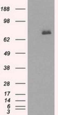 BTK Mouse anti-Human, Clone: OTI12H4, lyophilized, TrueMAB 100 &mu;g; Unconjugated:Antibodies,