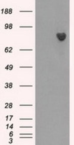 BTK Mouse anti-Human, Clone: OTI6H9, lyophilized, TrueMAB 100 &mu;g; Unconjugated:Antibodies,