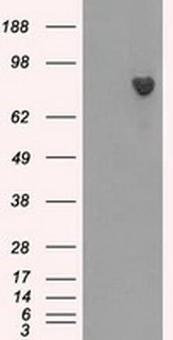 BTK Monoclonal Antibody (OTI6H9), TrueMAB , OriGene 100 &mu;L; Unconjugated:Antibodies,