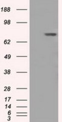 BTK Mouse anti-Human, Clone: OTI3E9, lyophilized, TrueMAB 100 &mu;g; Unconjugated:Antibodies,