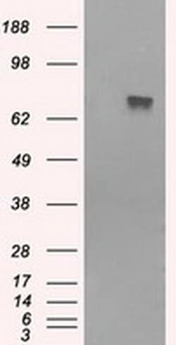 BTK Monoclonal Antibody (OTI1H7), TrueMAB , OriGene 100 &mu;L; Unconjugated:Antibodies,