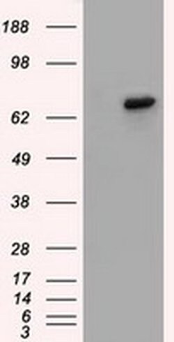 BTK Mouse anti-Human, Clone: OTI10E10, liquid, TrueMAB 100 &mu;L; Unconjugated:Antibodies,