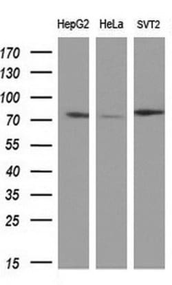 BTK Mouse anti-Human, Clone: OTI10E10, liquid, TrueMAB 100 &mu;L; Unconjugated:Antibodies,