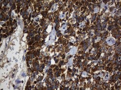 BTLA Mouse anti-Human, Clone: OTI4C2, lyophilized, TrueMAB 100 &mu;g; Unconjugated:Antibodies,