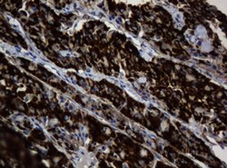 BTLA Monoclonal Antibody (OTI4C2), TrueMAB , OriGene 100 &mu;L; Unconjugated:Antibodies,