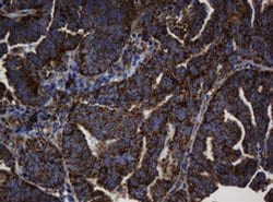 BTLA Monoclonal Antibody (OTI4C2), TrueMAB , OriGene 100 &mu;L; Unconjugated:Antibodies,