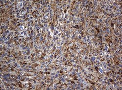 BTLA Monoclonal Antibody (OTI4C2), TrueMAB , OriGene:Antibodies:Primary
