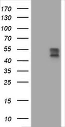 BTLA Monoclonal Antibody (OTI1B4), TrueMAB , OriGene:Antibodies:Primary