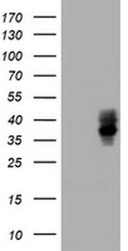 BTLA Monoclonal Antibody (OTI1E5), TrueMAB , OriGene 100 &mu;L | Buy Online | OriGene | Fisher Scientific