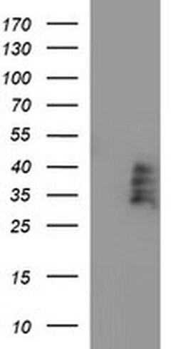 BTLA Monoclonal Antibody (OTI2F5), TrueMAB , OriGene 100 &mu;L; Unconjugated:Antibodies,