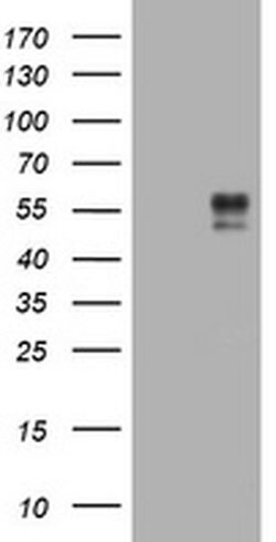 BTLA Monoclonal Antibody (OTI2G8), TrueMAB , OriGene:Antibodies:Primary